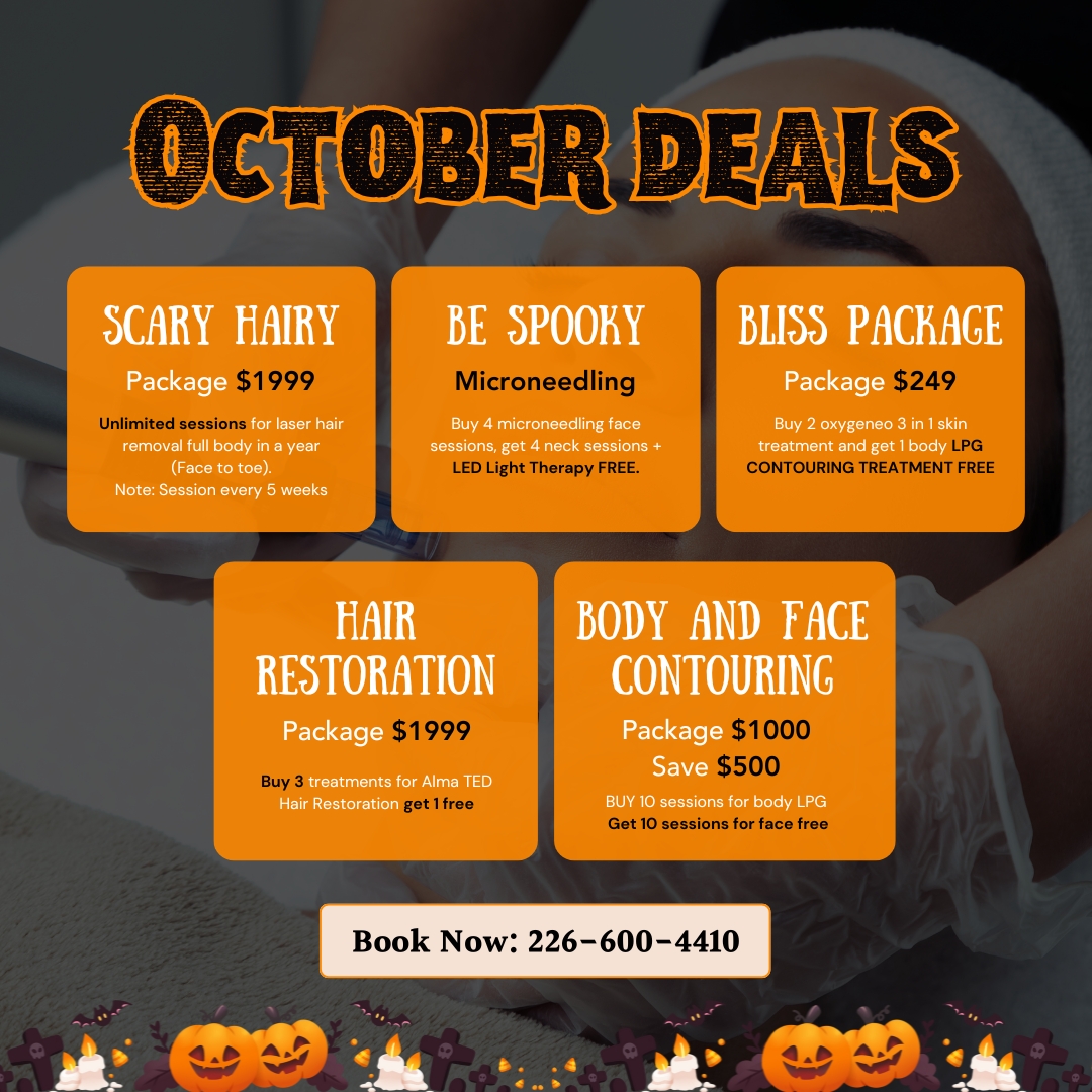 Deals Banner