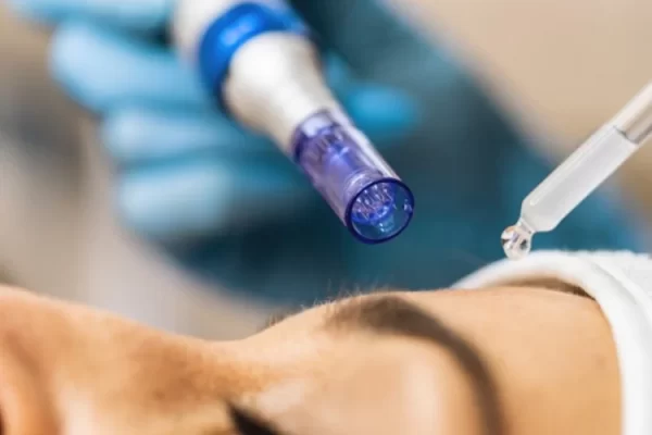 YourSkinRN+-+Skin+Rejuvenation