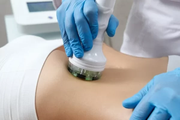 YourSkinRN+-+Skin+Tightening